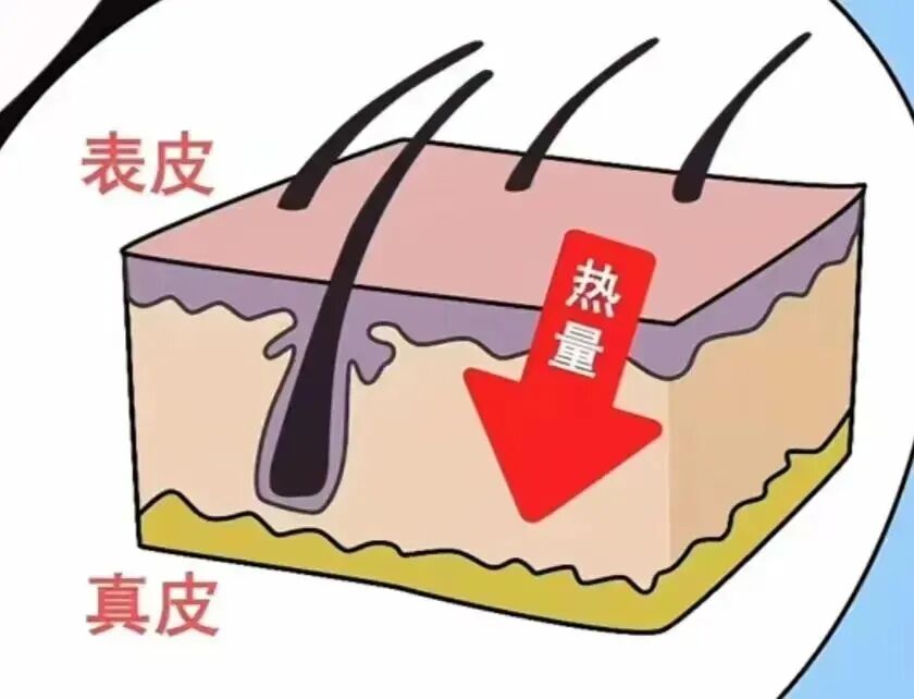 当心！取暖“神器”变“凶器”