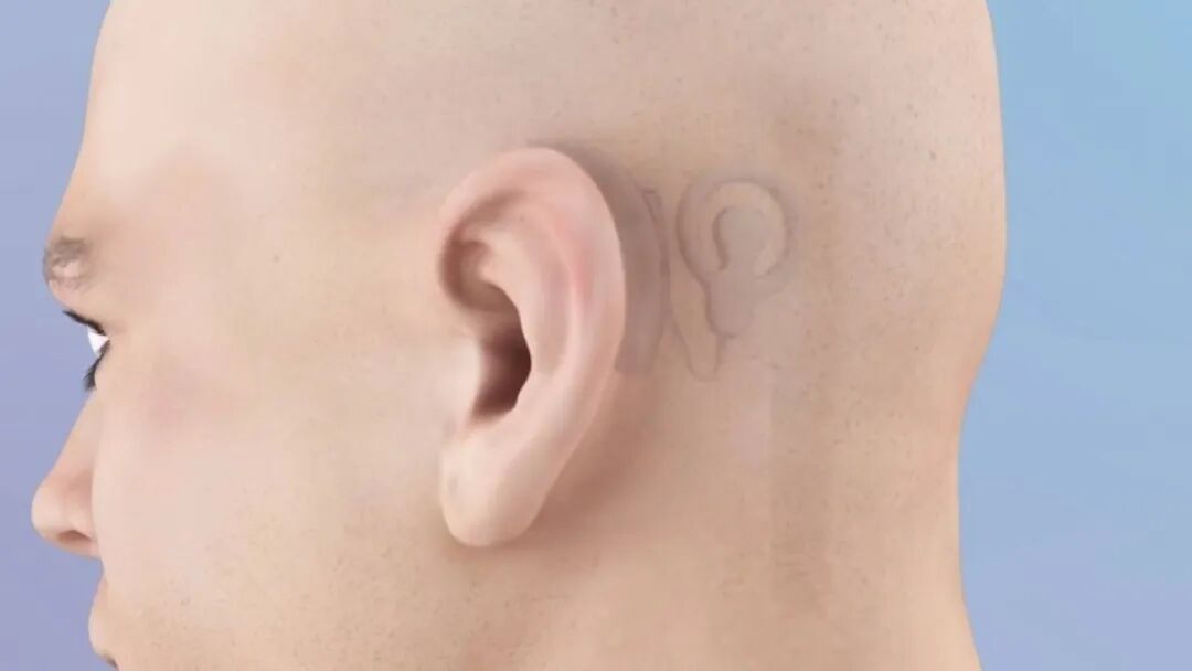 好消息！本月起，纳入医保！