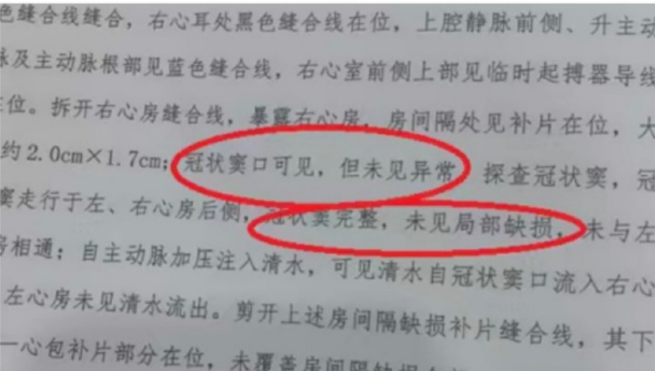 韩红为宁波小洛熙事件发声：这个病例错得太离谱；妈妈发布女儿尸检报告：未检见冠状窦型房间隔缺损，肋骨间切开的创口未缝合