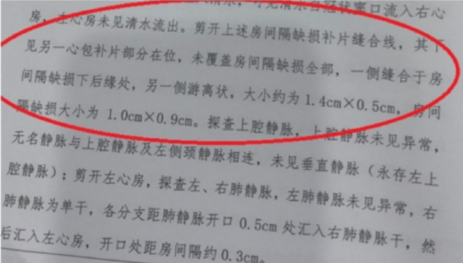 韩红为宁波小洛熙事件发声：这个病例错得太离谱；妈妈发布女儿尸检报告：未检见冠状窦型房间隔缺损，肋骨间切开的创口未缝合