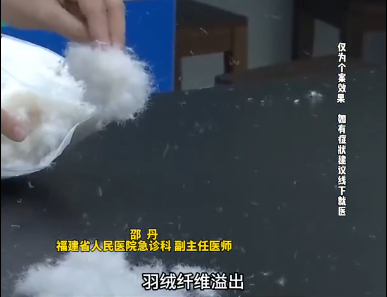 一个细节致呼吸衰竭!南通人快自查