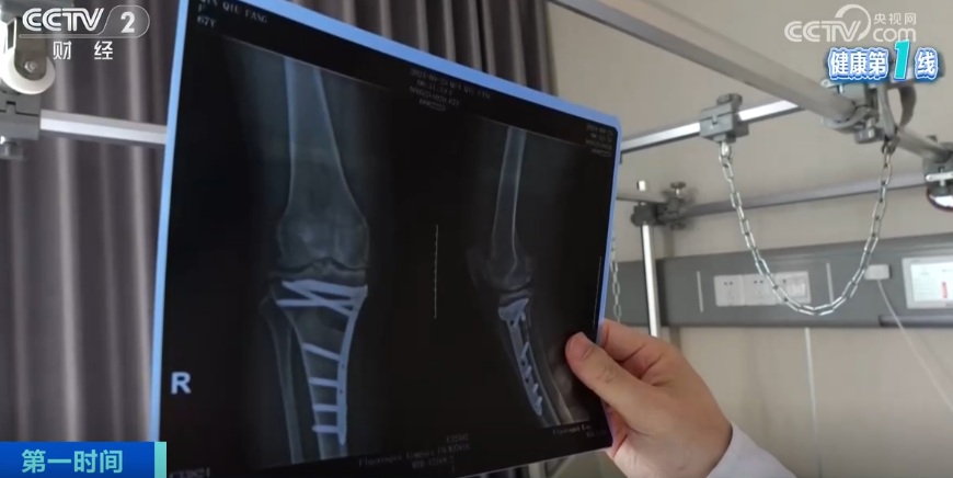 我国患者已超1亿人！头号致残性疾病，医生提醒→